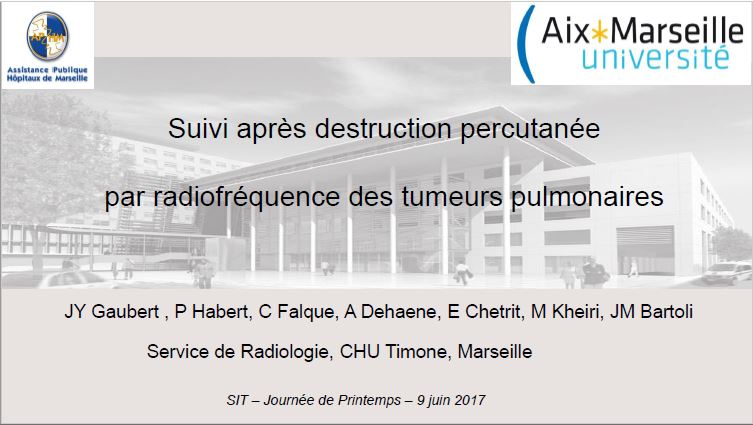  Suivi après destruction percutanée par radiofréquence des tumeurs pulmonaires