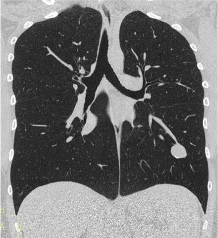 visuel cas clinique novembre 2025