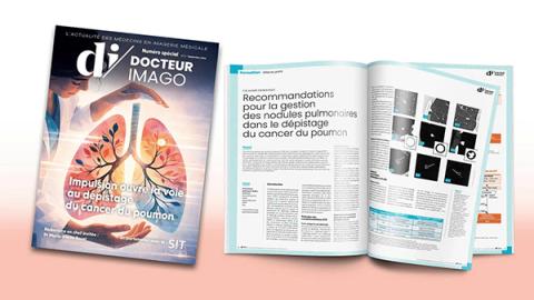 cancer pulmonaire à l'honneur dans le dernier numéro de Dr Imago