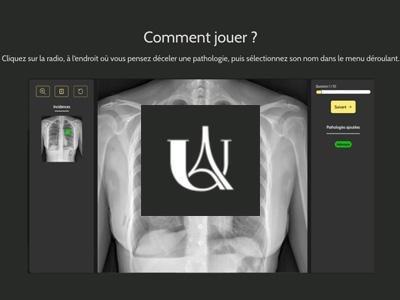 Découvrez le site d'auto-apprentissage de la radiographie thoracique et entraînez-vous !