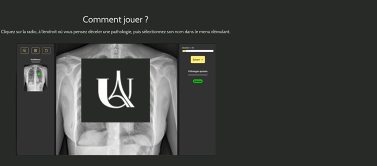 site d'auto-apprentissage de la radiographie thoracique